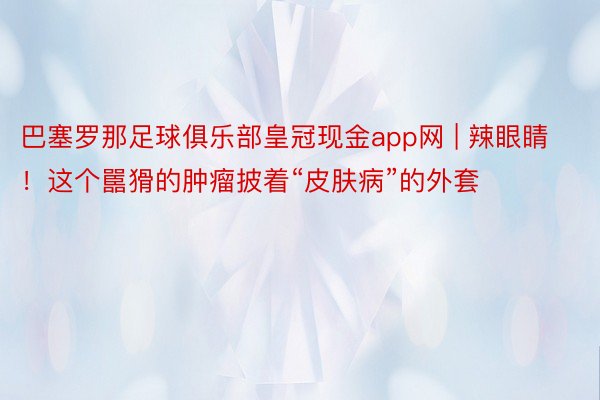 巴塞罗那足球俱乐部皇冠现金app网 | 辣眼睛！这个嚚猾的肿瘤披着“皮肤病”的外套